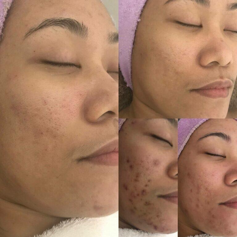 Dermalogica products at Salon Esvees